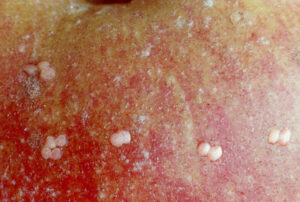 Cover photo for WNC Orchard Insect Pest Populations - July 20, 2021